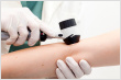dermatoscope-thumbnail
